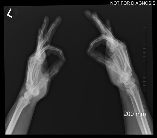 hands xray