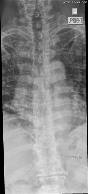 spine